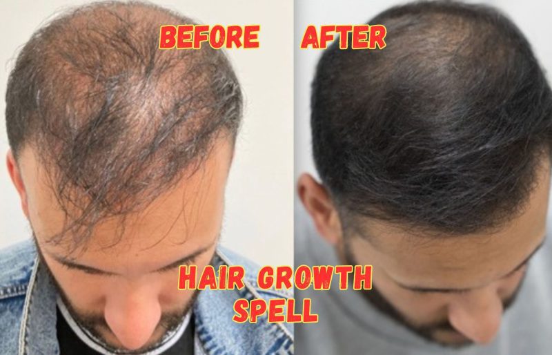 Hair Growth & Stop Hair Loss Spell